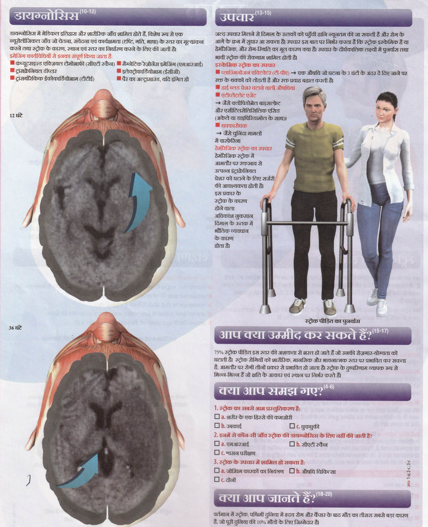 स्ट्रोक (आघात)